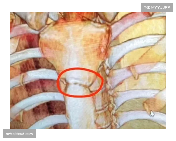 公羊外接手纳库阿伤情更新 胸部挫伤无大碍